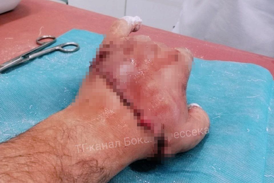        ,     