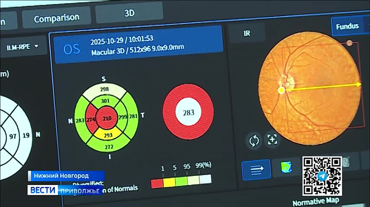 Первые в России! Нижегородские медики начали применять новую дозировку препарата для восстановления зрения