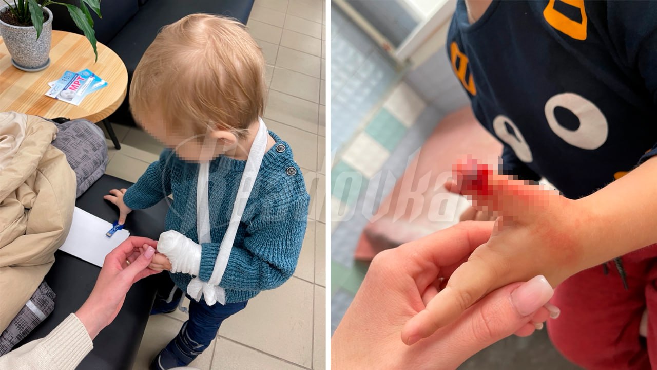 Воспитательница более 25 лет бьет детей в нижегородском детсаду — выяснилось это, когда одному из детей раздробило палец