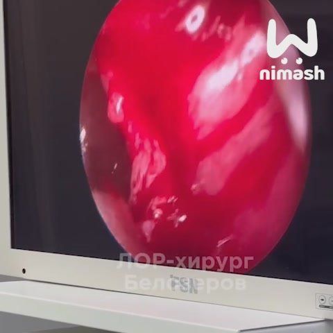 ������������� ����� �������������� �������� � ��������� ���������� ����� ����