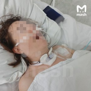 ����������� ������ �������� �������� �� ������������� ������� ��-�� ��������� ������ � ��������������, �� ����������� ���������� ����������� ������ � ������ ����� ��������� �������� �������