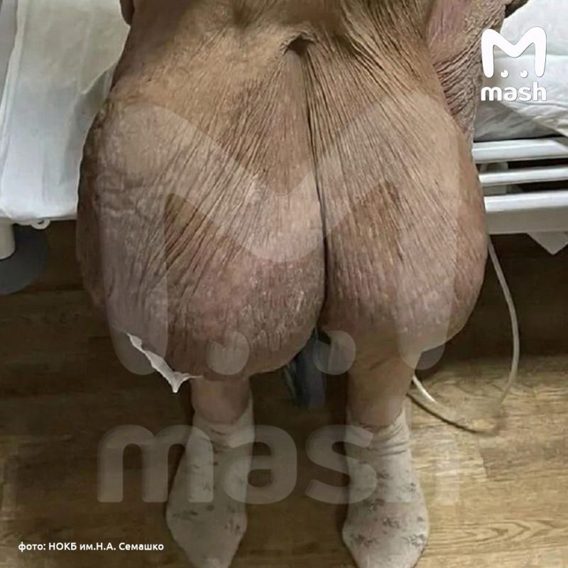 ���������� ����������� �� ������ �������� � ���������� ������������� ������� � ������ ���� ��� � �� ����� �������������� ��������� �����