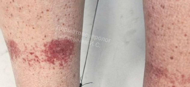 � ����������� ���������� ��������� �� ����� ��-�� ���������� ������ ����� ����� ����