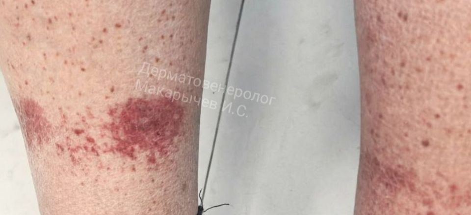 ����������� �������� ����� ����� ������ ����� � ��������