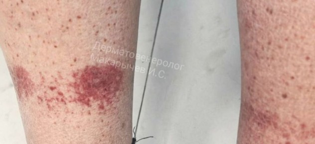 ����������� �������� ����� ����� ������ ����� � ��������