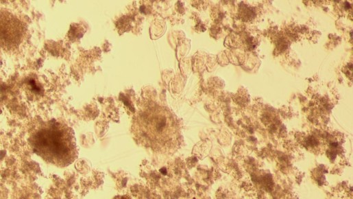 Как думаете, что это за пятнышки такие?