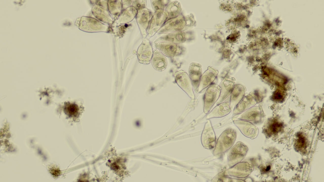 Как думаете, что это за пятнышки такие? Как думаете, что это за пятнышки такие?