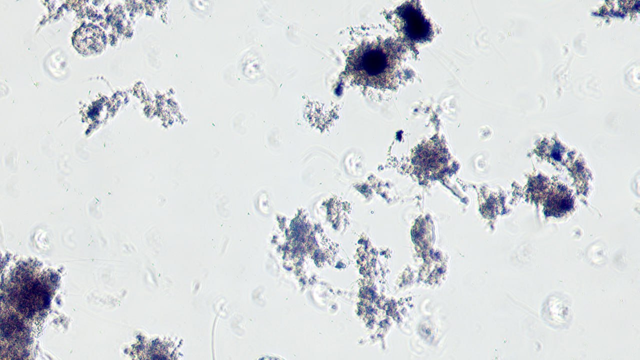 Как думаете, что это за пятнышки такие? Как думаете, что это за пятнышки такие?