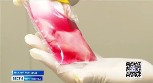 Пациентка, пережившая уникальную операцию Росса-Конно в Нижегородском кардиоцентре, готовится к выписке