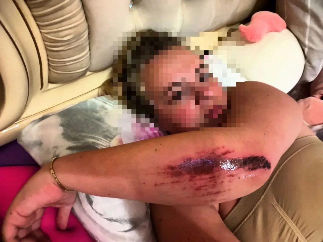 Девушка утверждает, что получила перелом позвонка после падения с лошади в конном клубе — владелица отрицает произошедшее и считает, что та пытается заполучить компенсацию Девушка утверждает, что получила перелом позвонка после падения с лошади в конном клубе — владелица отрицает произошедшее и считает, что та пытается заполучить компенсацию